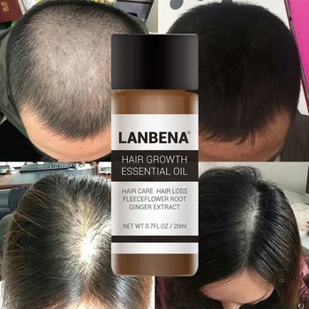 LANBENA Hızlı Güçlü Saç Büyüme Özü Ürünleri uçucu yağ Tedavisi Önlenmesi Saç Dökülmesi Saç Bakımı Andrea 20 ml